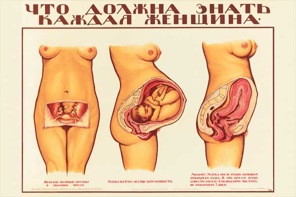 1970-7. Советский плакат: Что должна знать каждая женщина ч.2