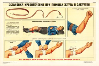 0348. Военный ретро плакат: Остановка кровотечения при помощи жгута и закрутки