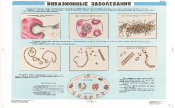 0875. Военный ретро плакат: Инвазионные заболевания